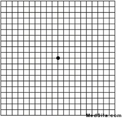 Сетка Амслера