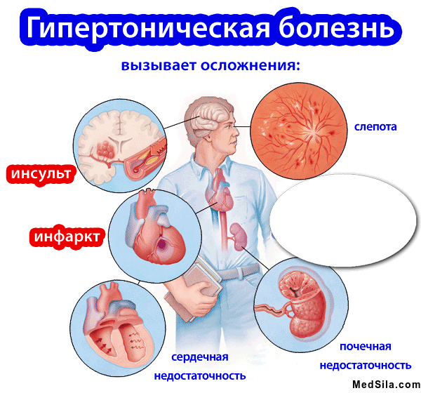 Осложнения АГ